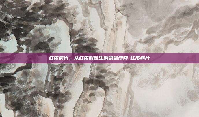 红皮病片,从红皮到新生的艰难博弈-红皮病片